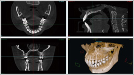 歯科用CTのイメージ写真