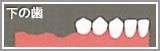 下の歯1
